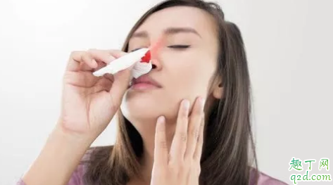 夏季总是留鼻血是什么原因 孩子流鼻血什么办法可以及时止住1