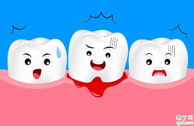 有哪些偏方可以治疗牙龈肿痛 上火牙龈肿痛有什么偏方1