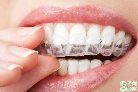 带牙套|带牙套后咬肌能变小吗 带牙套后饮食上有什么要注意的