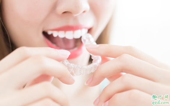 牙套的种类有哪些 哪种牙套矫正牙齿效果更好3