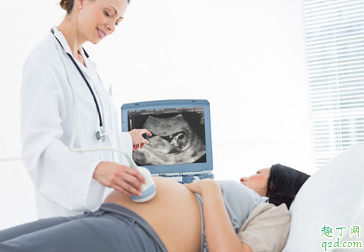 怀孕后哪几个部位会变黑 怀孕后怎么防止身体部位变黑3