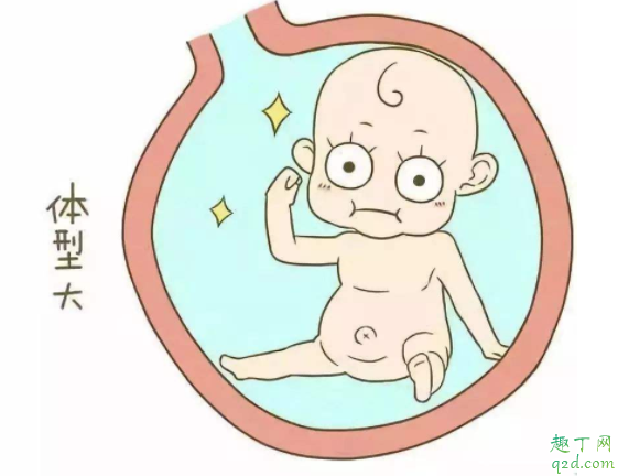 怎么看胎位是不是横位 胎儿横位怎么矫正胎位4