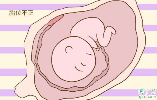 怀孕多久胎位就稳固了 正常的胎位是什么胎位1
