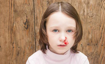 孩子常流鼻血正常吗 孩子常流鼻血该怎么解决