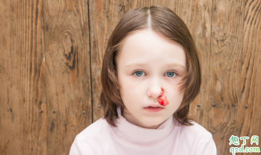 孩子常流鼻血正常吗 孩子常流鼻血该怎么解决1