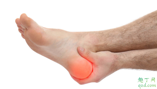 长期脚跟疼是咋弄的 脚后跟痛如何护理2