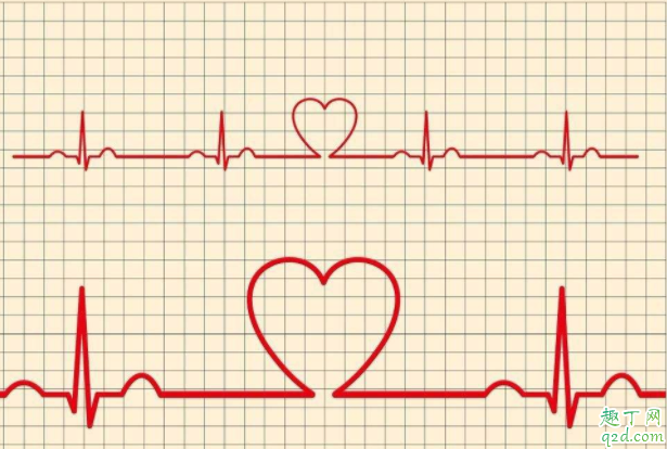 心电图和心脏彩超有什么不同 心脏彩超可以检查什么2