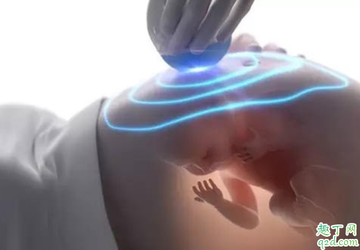 怀孕九个月怎么可以生的更快 为什么有的宝宝提早生3