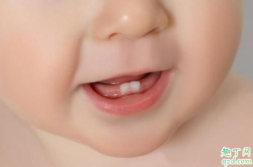 宝宝出牙一般在几个月 宝宝出牙有什么状态1