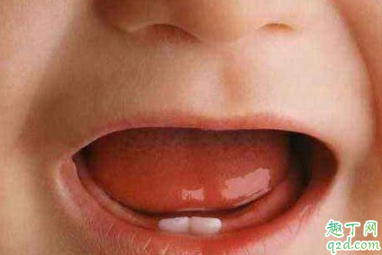 宝宝出牙为什么会发烧 如何判断宝宝是出牙期发烧 2