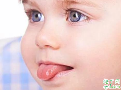 小宝宝要剪舌系带是真的吗 如何判断宝宝舌系带是否正常 2
