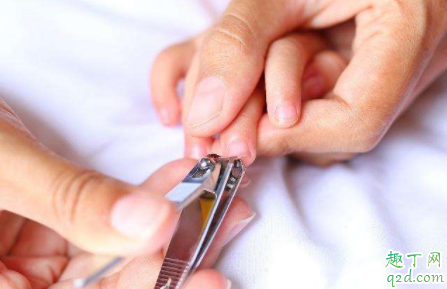 宝宝指甲过长有什么危害 宝宝剪指甲工具怎么选 2
