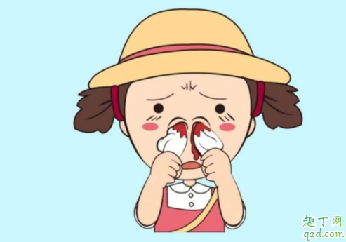 孕晚期流鼻血是什么情况 孕期流鼻血会不会影响生产2