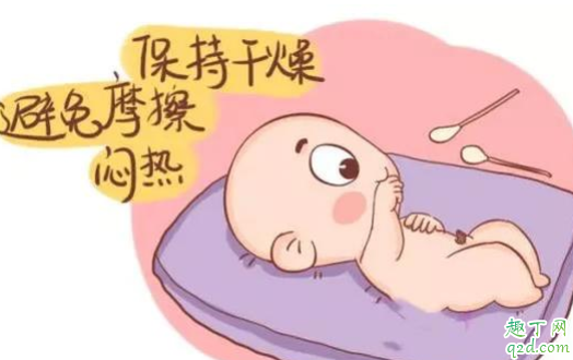 新生儿肚脐多长时间能痊愈 脐带未脱落前能给宝宝穿纸尿裤吗 3