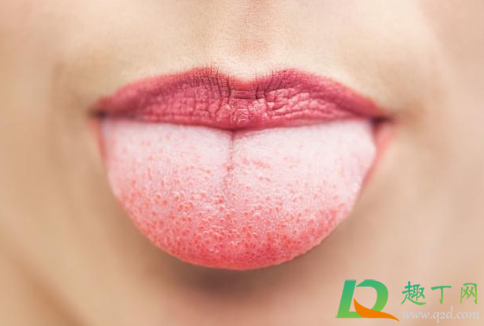 舌苔发黄是什么原因引起的2