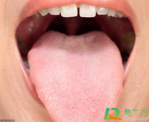 舌苔发黄是什么原因引起的3