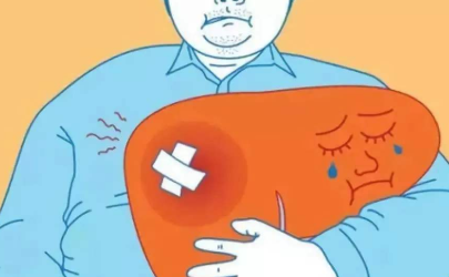脂肪肝是怎么回事严重吗