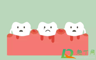 牙龈出血什么办法可以止血1