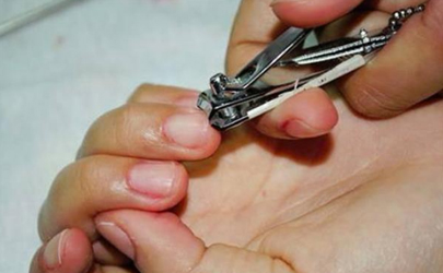 剪指甲是不是旁边指甲不要剪弯进去