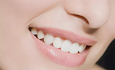 牙石最简单的清除方式你知道吗3