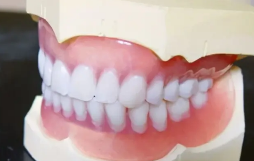 牙齿凹槽上面有黑色是蛀牙吗2
