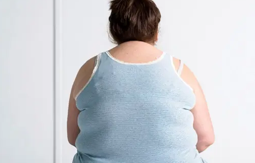 专家称肥胖是不孕不育的直接诱因有道理吗1