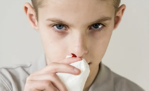 吹空调流鼻血怎么解决？吹空调流鼻血买加湿器有用吗