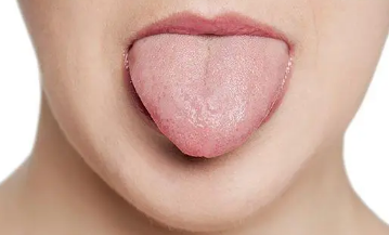 舌头烫起泡了能自己恢复吗3