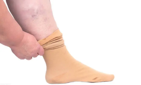 静脉曲张袜长度到脚踝可以吗-静脉曲张袜长度怎么选择的