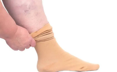 靜脈曲張襪長度到腳踝可以嗎