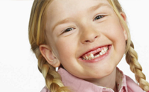孩子换牙期如何护理牙齿 孩子换牙期的护理妙招介绍