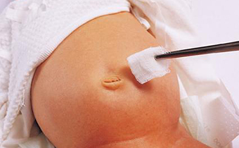 新生儿肚脐有脓怎么办 新生儿肚脐每天消毒几次