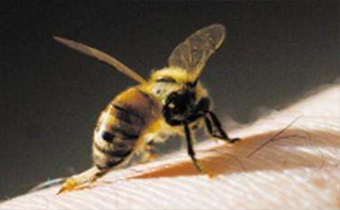 蜂疗能治什么病 蜂疗的作用与功效