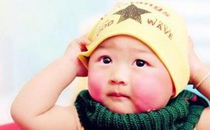 宝宝脸上的“高原红”可能是病 告别“高原红”方法