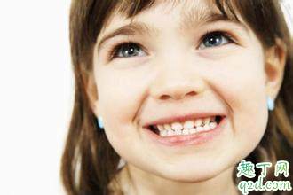 儿童牙齿为什么会变黄 预防牙黄有妙招