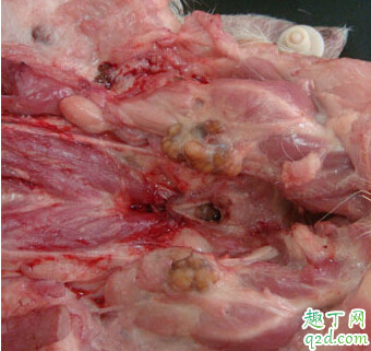庆丰包子铺粥中喝出钢丝 吃了有淋巴的猪肉有什么危害